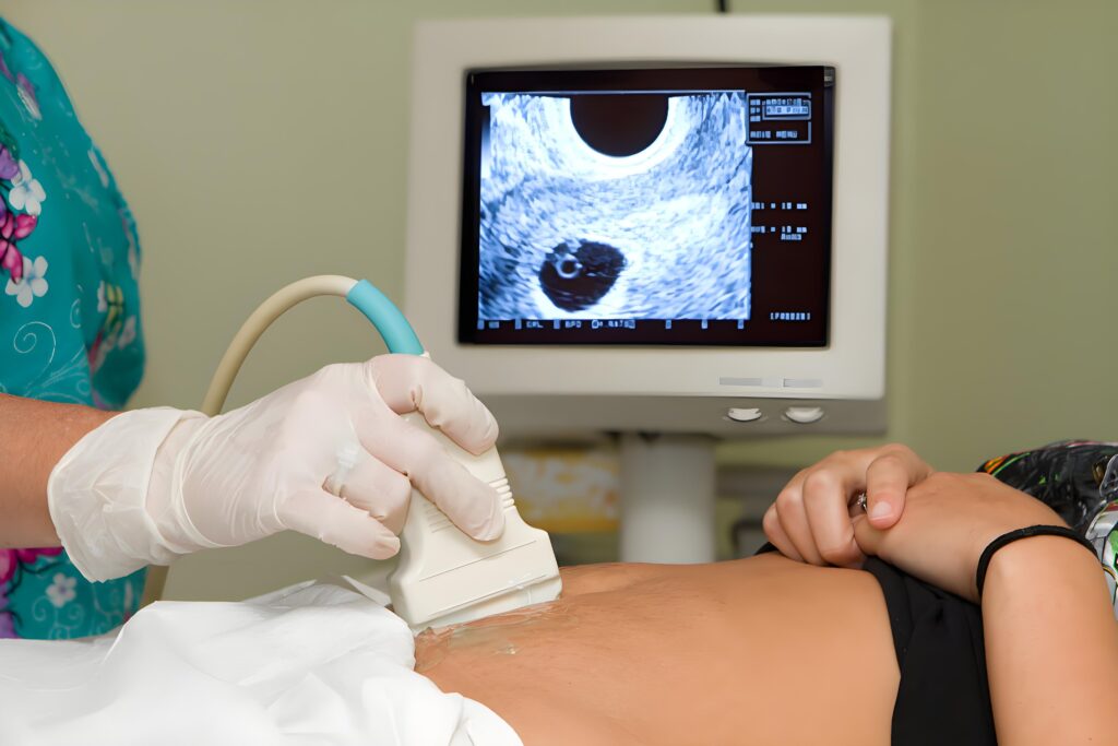 Una imagen de ultrasonido mostrando un escaneo fetal.